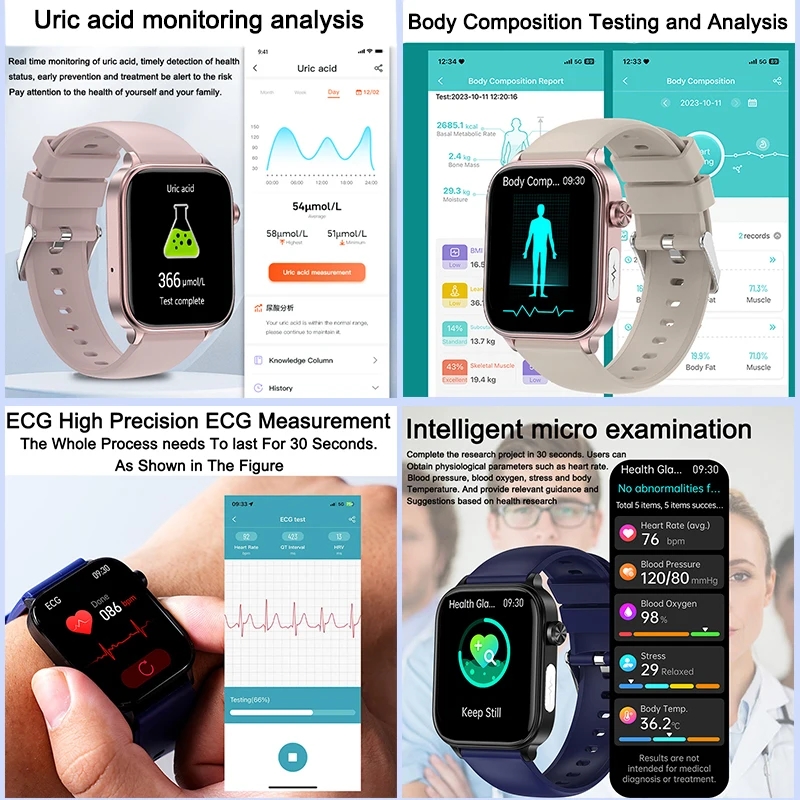 2025 Baru Untuk XIAOM1 ECG+PPG - Smartwatch New Watches 2025 ulasan dan harga